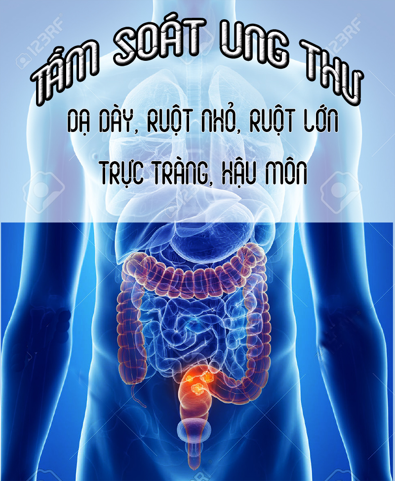 tam soat ung thu dai trang, truc trang