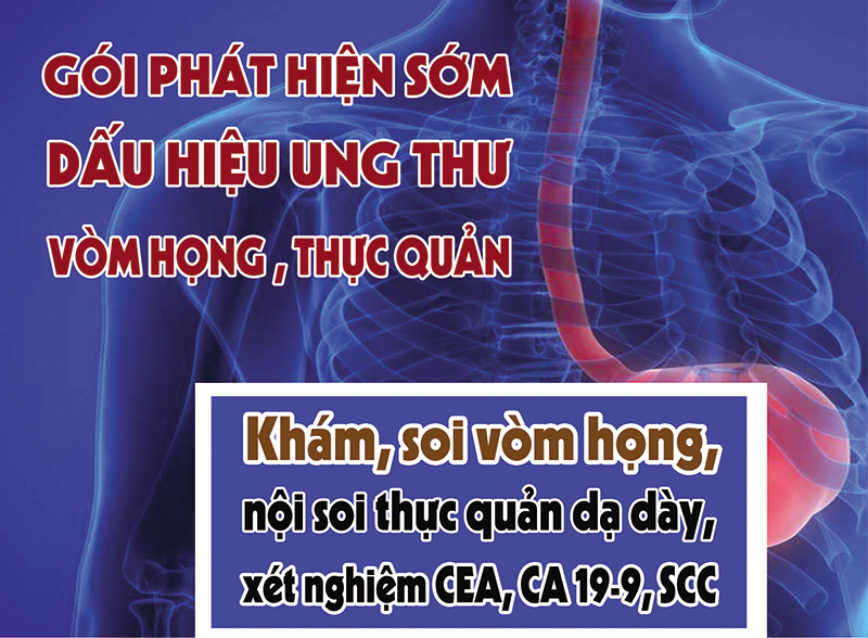 tam soat ung thu vom hong